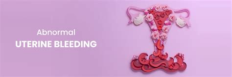 Abnormal Uterine Bleeding: Types, Symptoms, Treatment