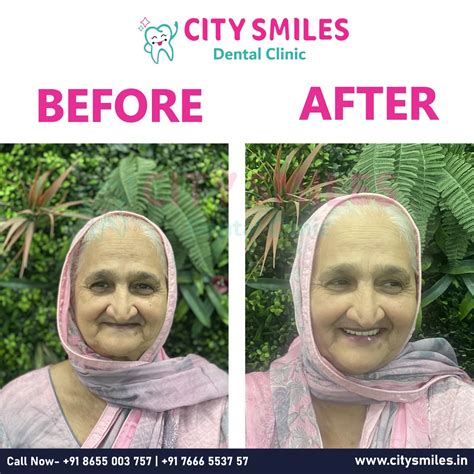 Transform Your Smile – Because You Deserve to Shine! | City Smiles ...