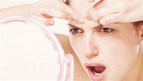 Image result for Exploding Back Zits