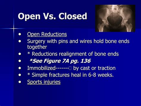PPT - Bone Fractures and Articulations PowerPoint Presentation, free download - ID:8590012