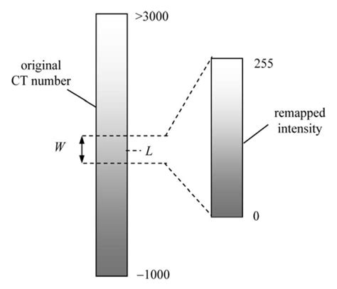 Image result for Brightness Verses Window Level