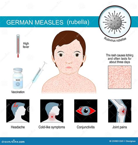Rubella Rash Vs Measles Rash Kids, Vaccines And Autism: Will A New