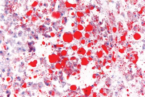 Oil Red O kit - Biognost