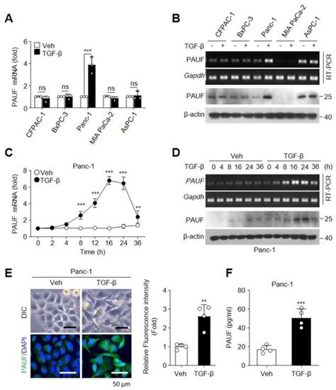 TGF-β-Induced PAUF Plays a Pivotal Role in the Migration and Invasion ...