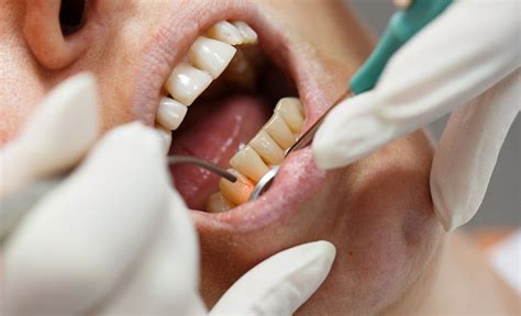 Studio Dental - Best Dental Hospital in Hyderabad - Dental Clinic ...