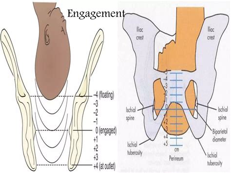 Mechanism of normal labour | PPTX