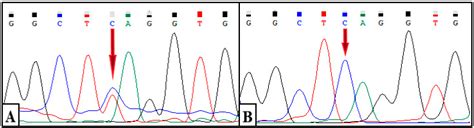 Image result for ASD Pro Tutorial