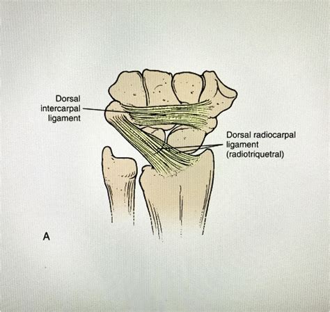 Management of chronic scapholunate ligament injury - Journal of ...