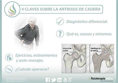4 claves sobre la artrosis de cadera | FisioOnline