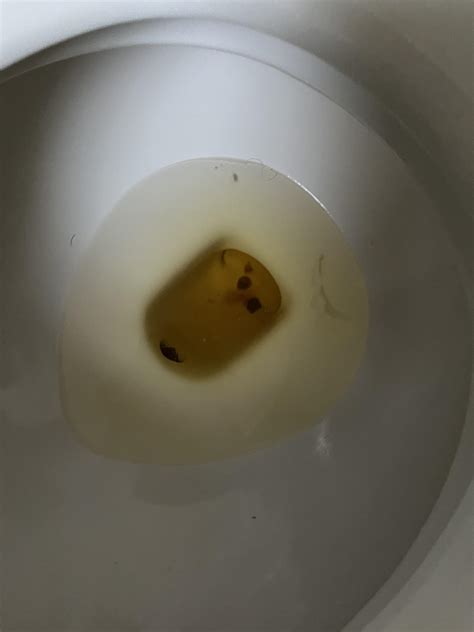 Extreme pain in testicle last night pee’d blood clot looking things ...