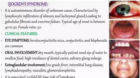 Connective tissue diseases | PPTX