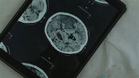 3 days without a phone: the brain reset that no one is talking about (yet)