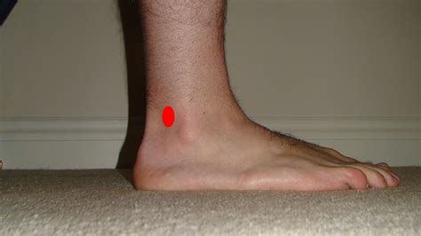 Pain Behind Ankle - Runners Forum