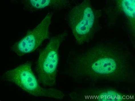 AIRE antibody (CL488-66262) | Proteintech