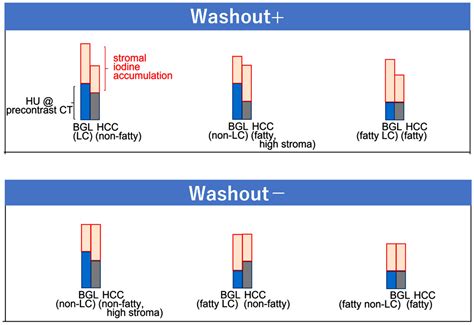 The Washout of Hepatocellular Carcinoma at Portal Venous Phase vs ...