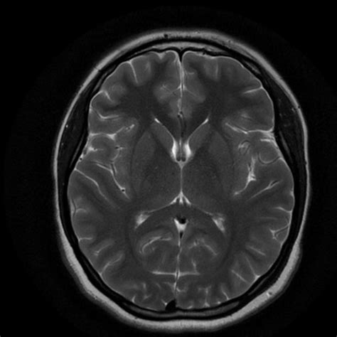 BRAIN MRI 2021 | Kaggle