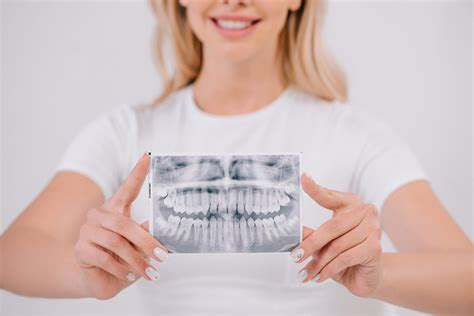 What Patients Don't Know About Dental X-Rays - Aubrey Baudean, DDS