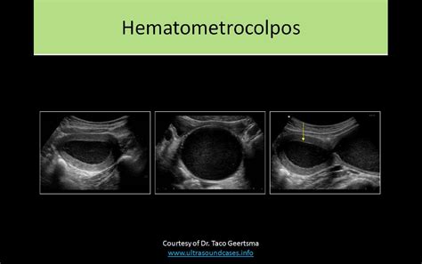 OB GYN Ultrasound Registry Review