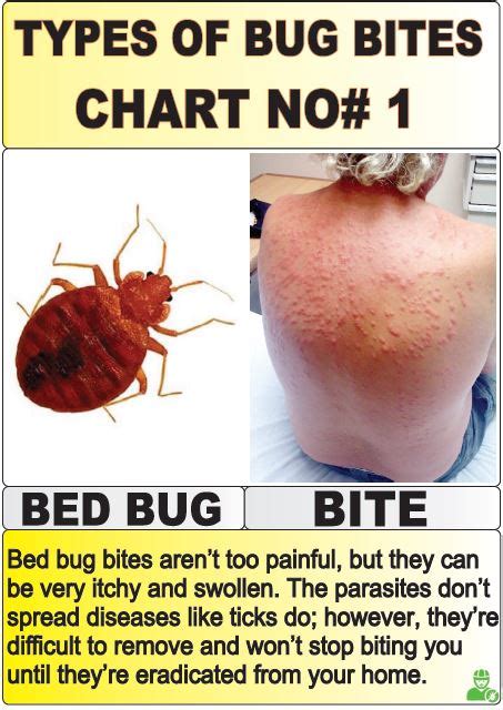 Image result for Bug Bite Identification Chart