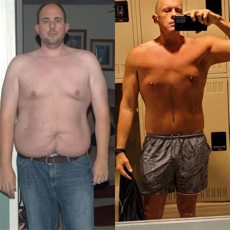 M/45/6'1” [407-197] (20 years) - left image was around 310lbs, I'm in ...