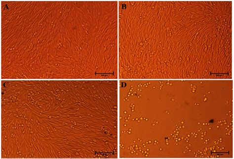 Hydrothermal Synthesis of Multifunctional Bimetallic Ag-CuO Nanohybrids ...