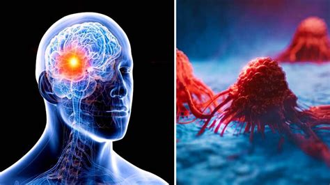 Brain Stroke Early Signs: প্রাণঘাতী হতে পারে ব্রেন স্ট্রোক, চিনে নিন এর ...