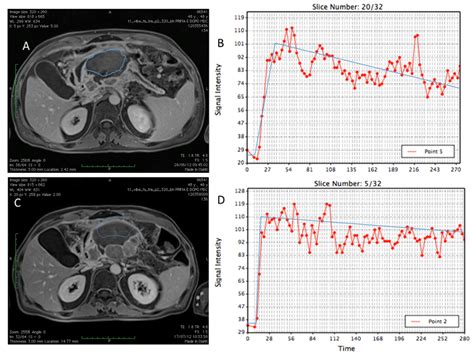 A Systematic Review about Imaging and Histopathological Findings for ...