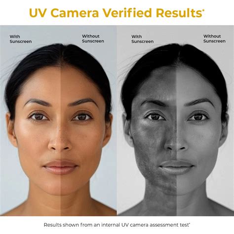 Shop Self Dissolving Microneedle Acne Patches | 8 Patches for Healthy ...