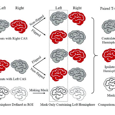 Image result for Contralateral Side