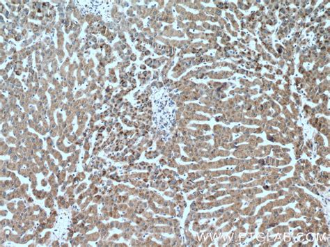 PEX19 antibody (14713-1-AP) | Proteintech