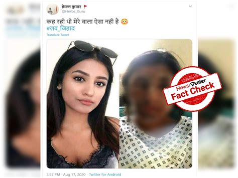 Fact Check: Viral photos of woman who suffered acid burns shared with ...