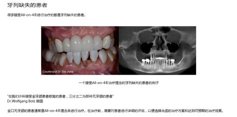 来南京美奥口腔做瑞典诺贝尔PMC种植牙可享受人保承保哦！ - 口腔资讯 - 牙齿矫正网