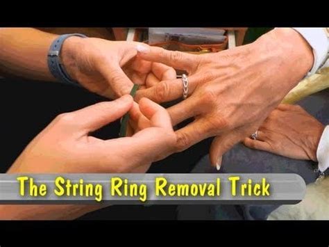 Image result for Ring Removal String Technique