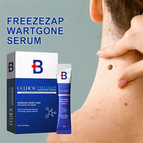 20 piezas removedor de verrugas común natural y seguro removedor de verrugas planas para el ...