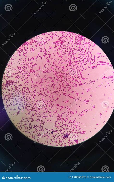 Gram Staining , Is A Method Of Differentiating Bacterial Species. Gram ...