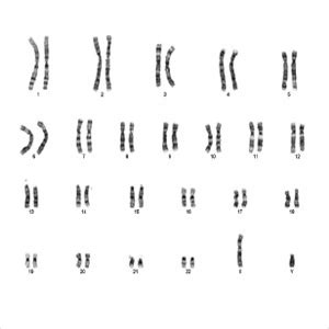 Image result for Set Cover Algorithm C Programe