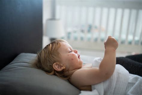 How do you identify and treat common skin conditions in babies ...