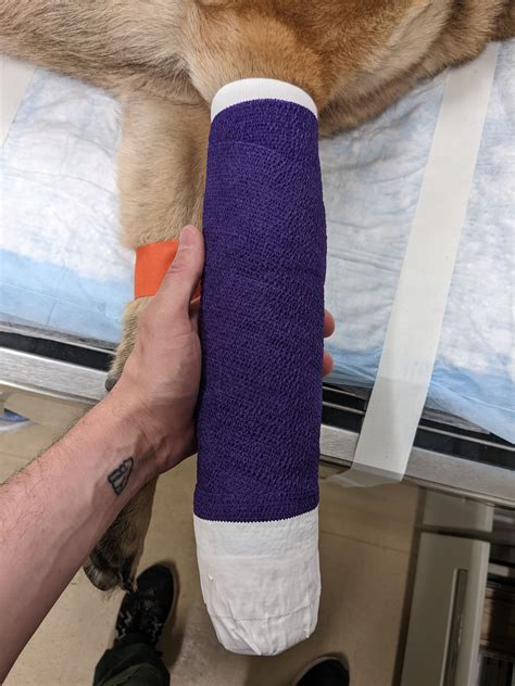 Modified Robert-Jones Bandage - Brian's Bandages