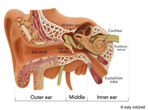 Understanding Hearing Loss | MESHGuides