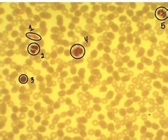 Image result for Normal Blood Segmenter Values