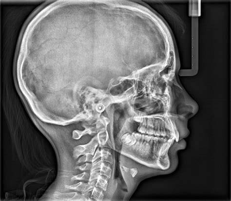 Cone Beam Computed Tomography - R B Kothari Polydiagnostic Centre and ...