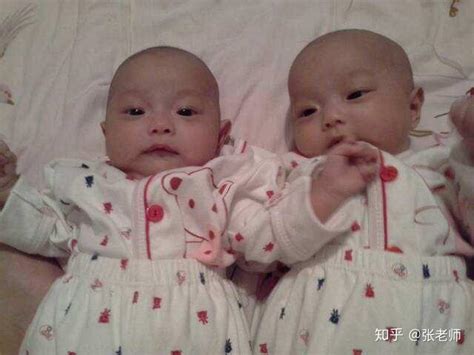 双胞胎或者多胞胎是怎么形成的？ - 知乎