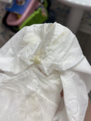 Clumpy Discharge 的图像结果