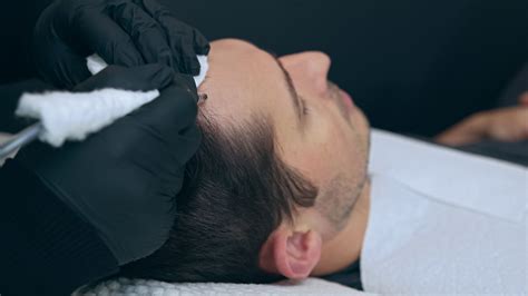 Is SMP Right for You? Signs You’re a Good Candidate for Scalp ...