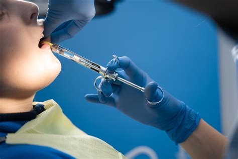 Dental Implant Procedure: Step-by-Step into Sessions - Dentfix