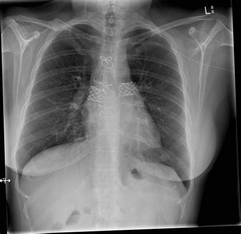 xray kesehatan