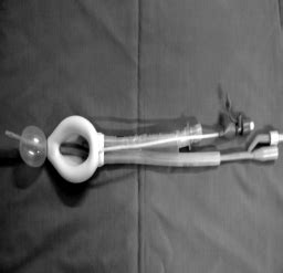 Image result for Patient Bad Example