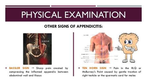 Image result for Appendicitis Assessment Signs