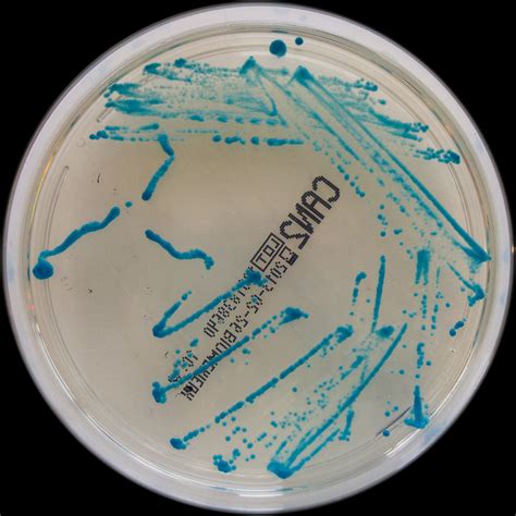 Kuvatulokset haulle candida