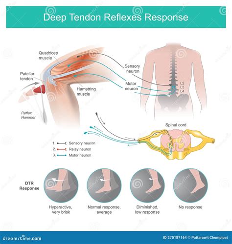 Hyperactive Reflexes 的图像结果